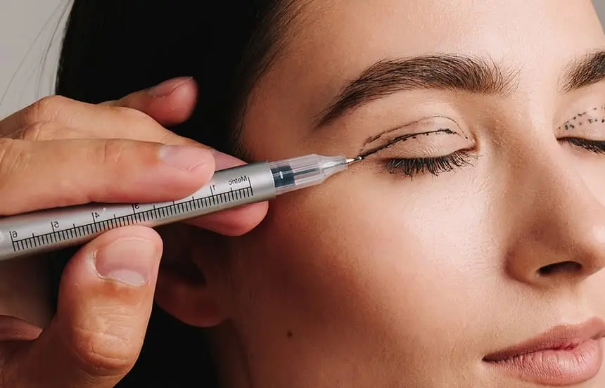 Marked upper eyelid receiving a local anaesthetic injection before blepharoplasty
