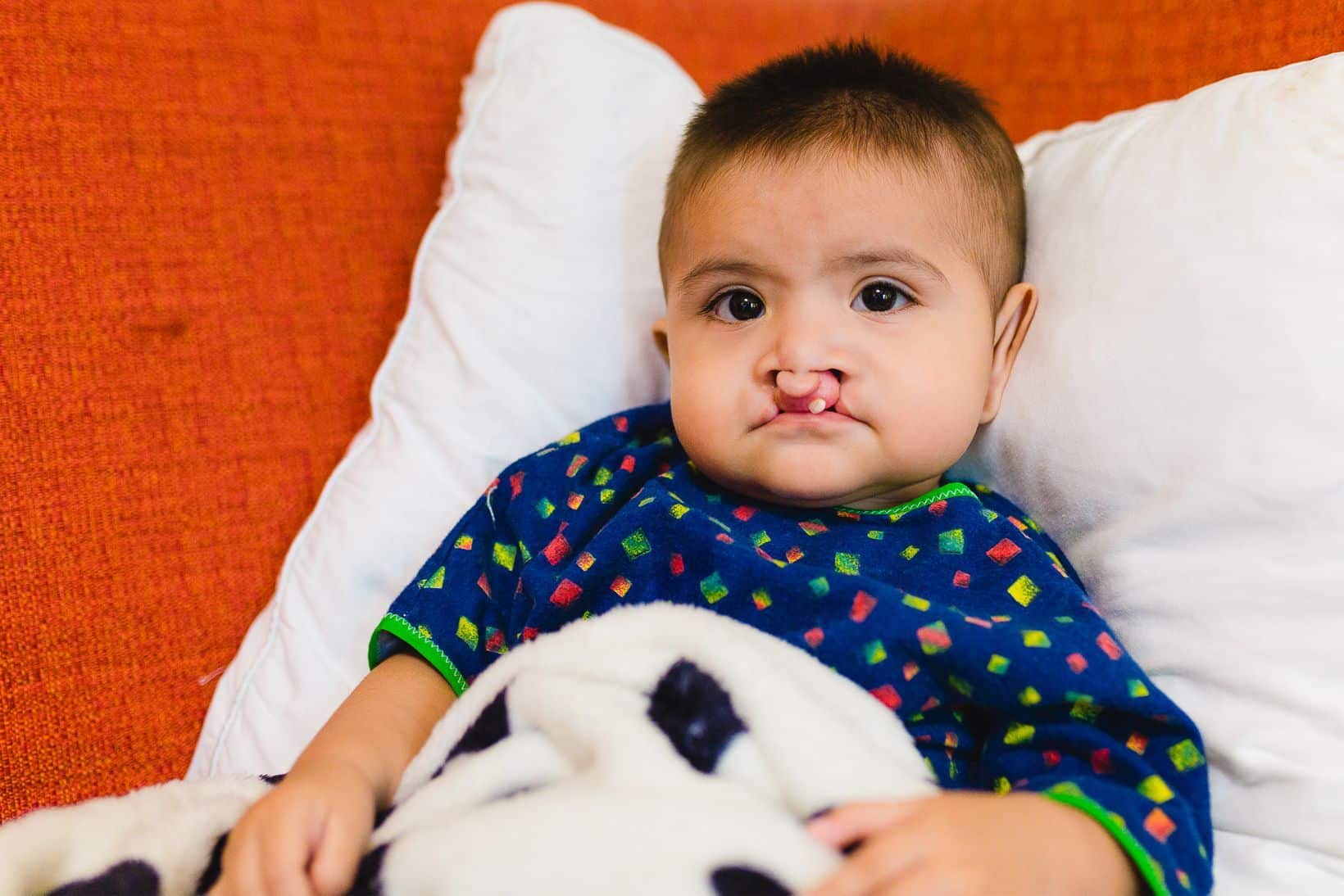 Cleft Palate and Cleft Lip Program funded by the International Friendship Club of Puerto Vallarta AC.